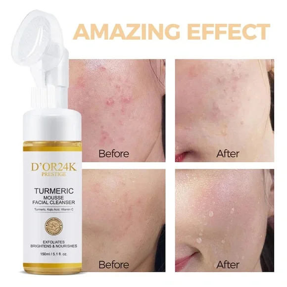 D’OR24K Turmeric Mousse Facial Cleanser - White and Gold - Picture 2 of 5